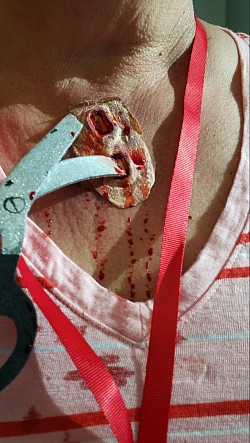 This is what happens when you  run with scissors